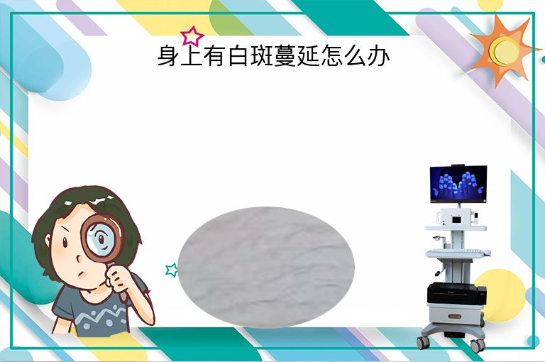 https://www.bdfsjzyy.com/d/file/p/2f7bfeb35ca728d1c1f061fc2bb1c1f6.jpeg