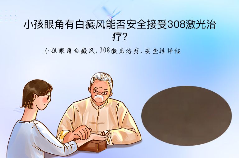 小孩眼角有白癜风能否安全接受308激光治疗？”
