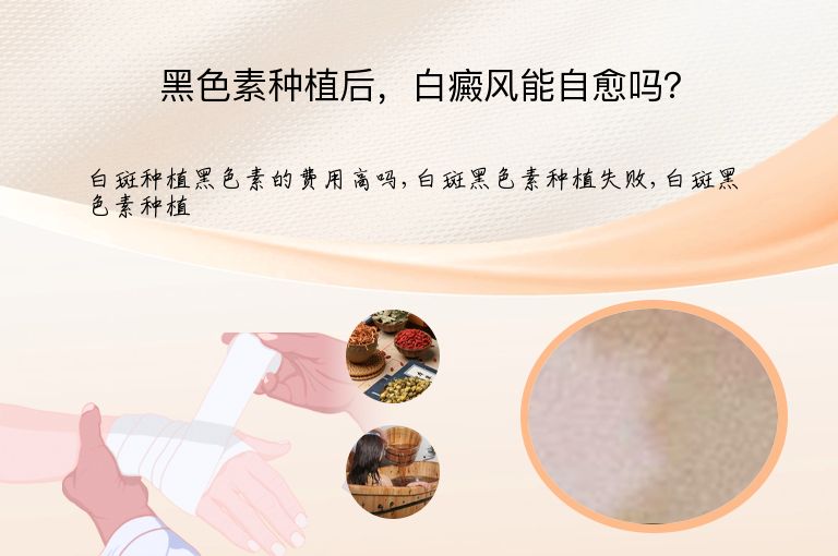 黑色素种植后，白癜风能自愈吗？”