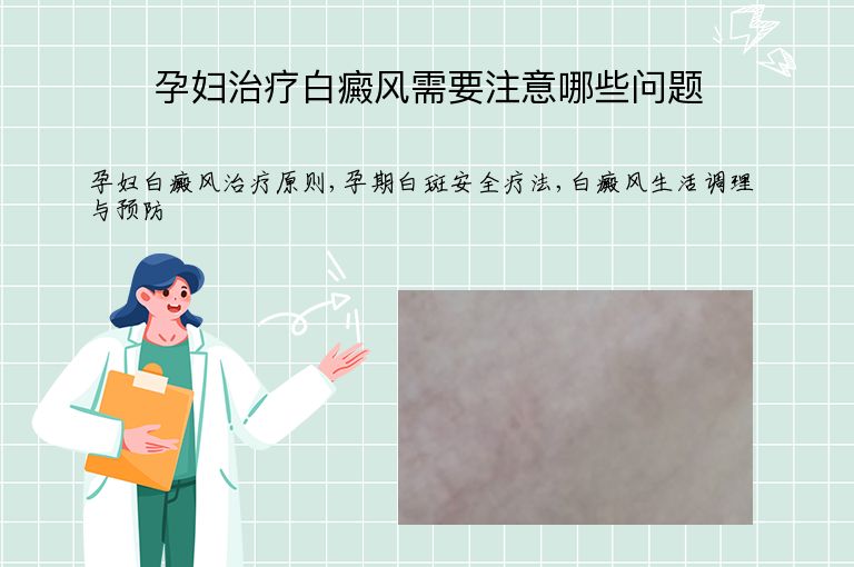 孕妇治疗白癜风需要注意哪些问题”