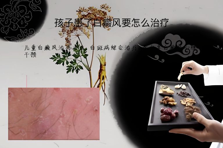 孩子患了白癜风要怎么治疗”