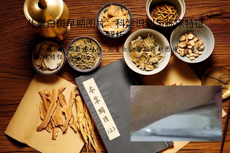儿童白斑早期图片:科学识别与临床特征解析