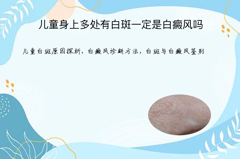 儿童身上多处有白斑一定是白癜风吗”