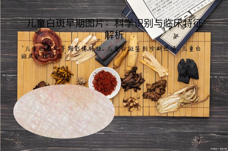 儿童白斑早期图片:科学识别与临床特征解析