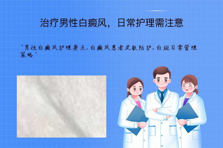 治疗男性白癜风,日常护理需注意