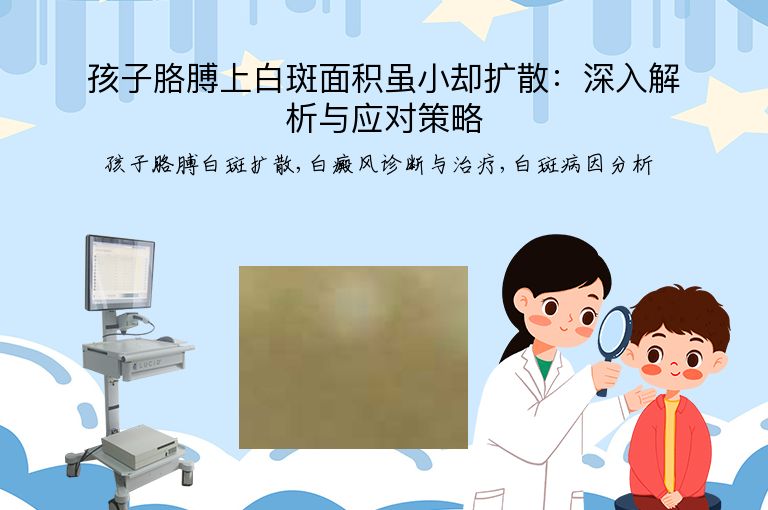 孩子胳膊上白斑面积虽小却扩散：深入解析与应对策略”
