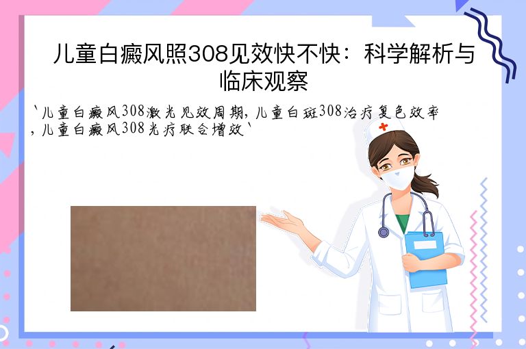 儿童白癜风照308见效快不快:科学解析与临床观察