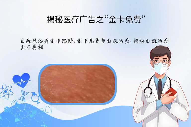 揭秘医疗广告之“金卡免费””