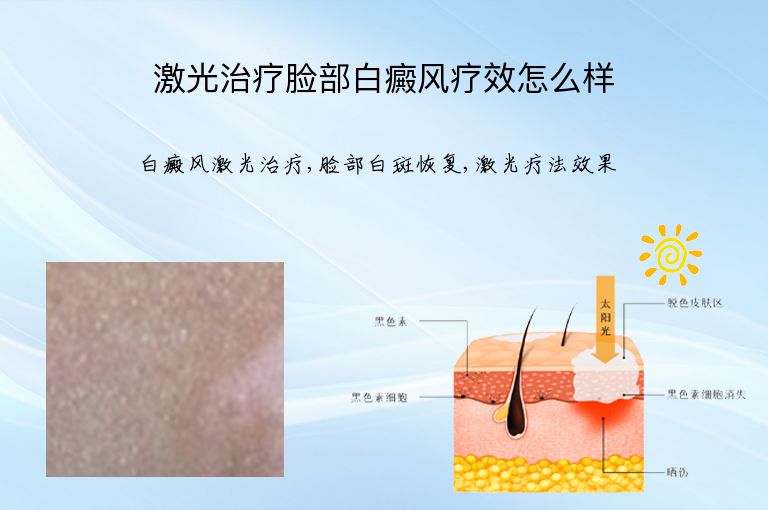 https://www.bdfsjzyy.com/d/file/p/a78bbe55105f4e3e3f4ce788db3f1081.jpeg