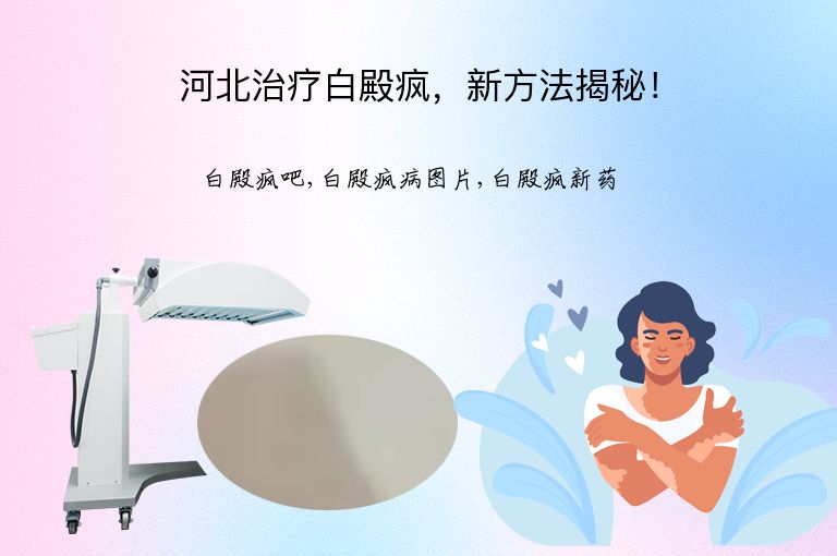 河北治疗白殿疯,新方法揭秘!”