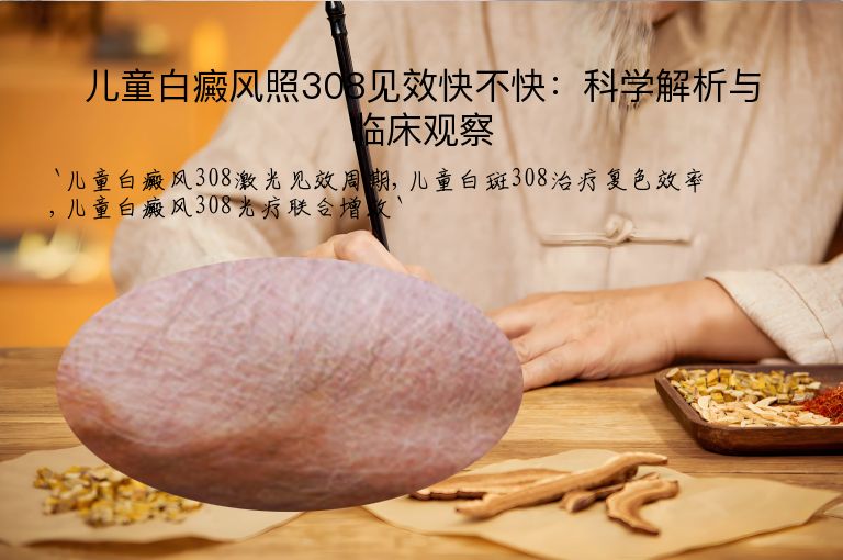 儿童白癜风照308见效快不快：科学解析与临床观察