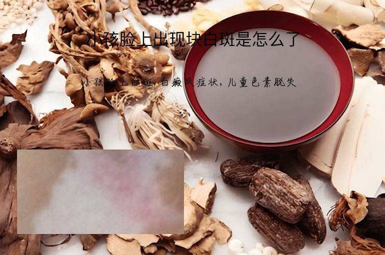 小孩脸上出现块白斑是怎么了”