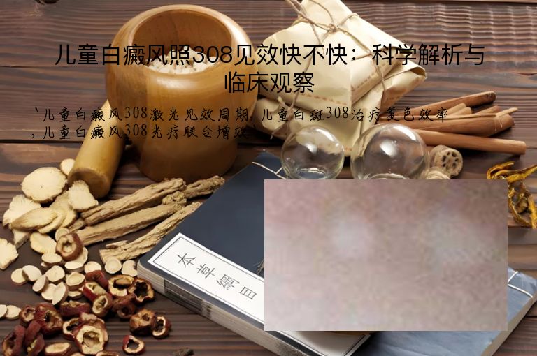 儿童白癜风照308见效快不快：科学解析与临床观察”