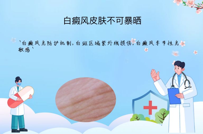 白癜风皮肤不可暴晒