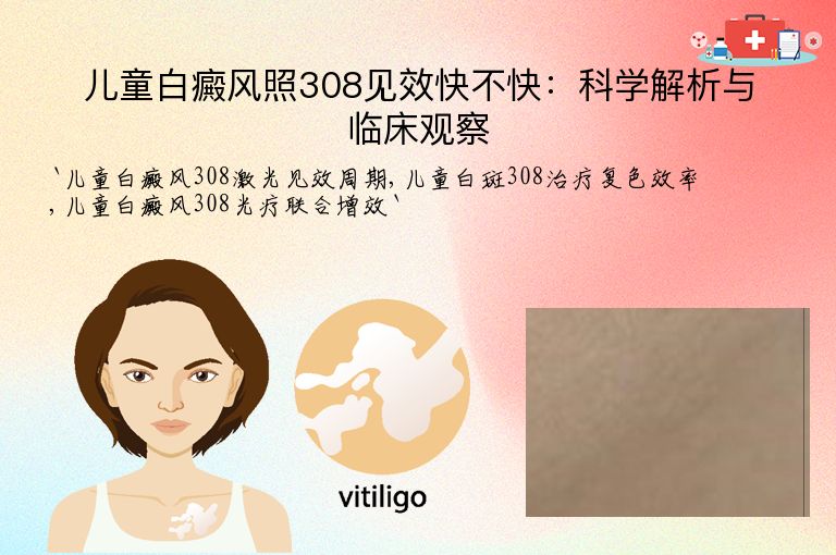儿童白癜风照308见效快不快：科学解析与临床观察
