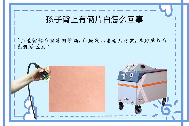孩子背上有俩片白怎么回事