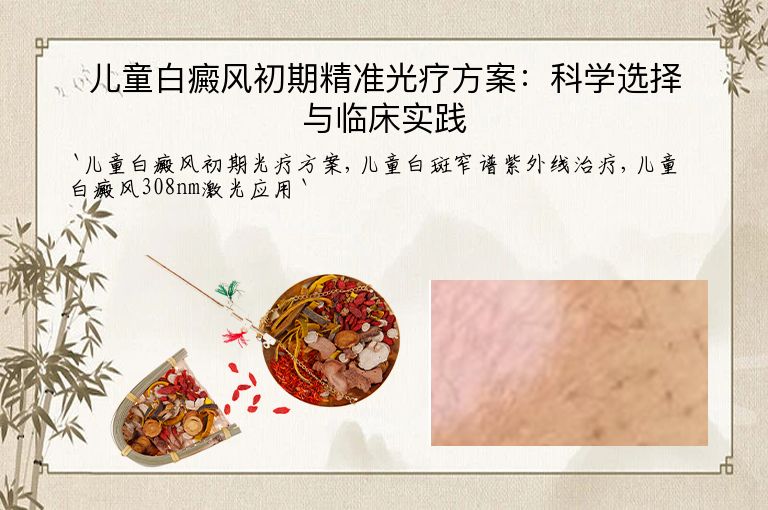 儿童白癜风初期精准光疗方案：科学选择与临床实践