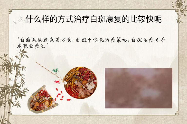什么样的方式治疗白斑康复的比较快呢