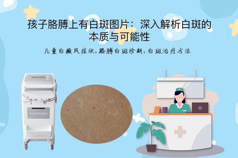 https://www.bdfsjzyy.com/d/file/p/67f7a95a8739e39c166c0d0b6bc3d278.jpeg
