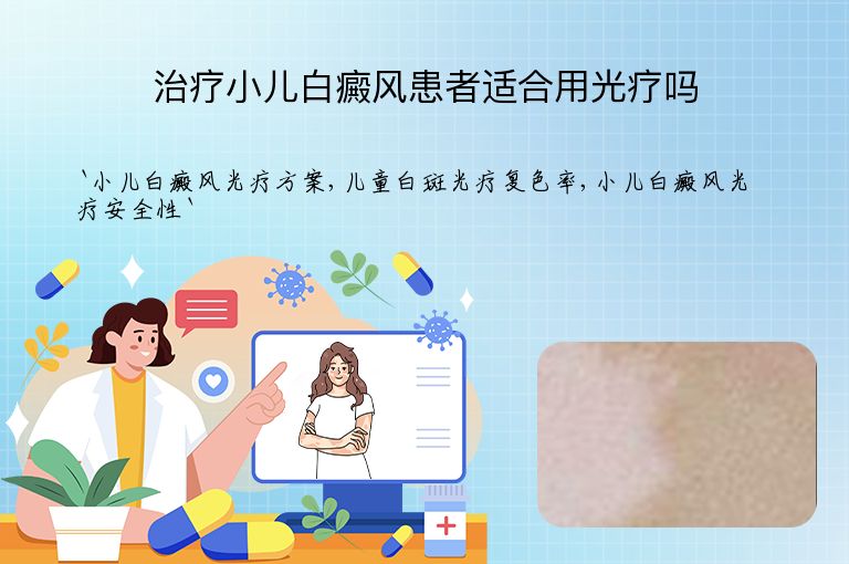 治疗小儿白癜风患者适合用光疗吗