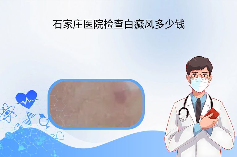 石家庄医院检查白癜风多少钱”