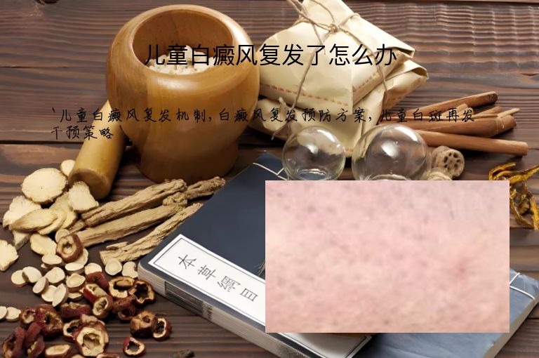 儿童白癜风复发了怎么办”