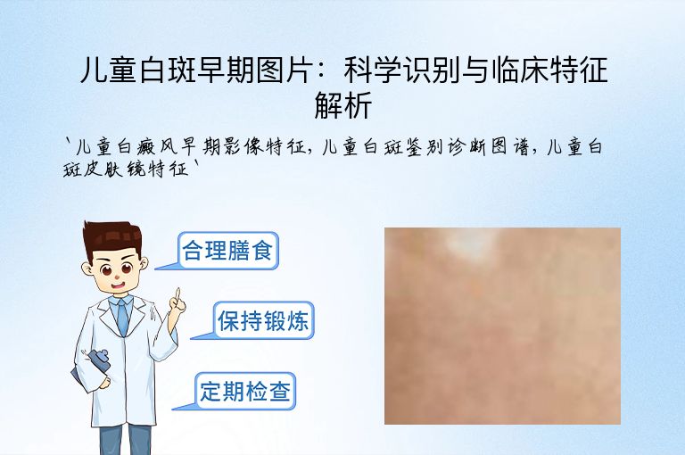 儿童白斑早期图片：科学识别与临床特征解析