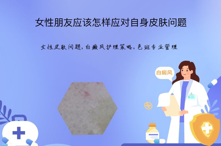 女性朋友应该怎样应对自身皮肤问题”