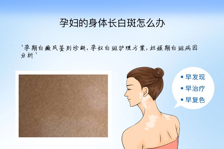 孕妇的身体长白斑怎么办”