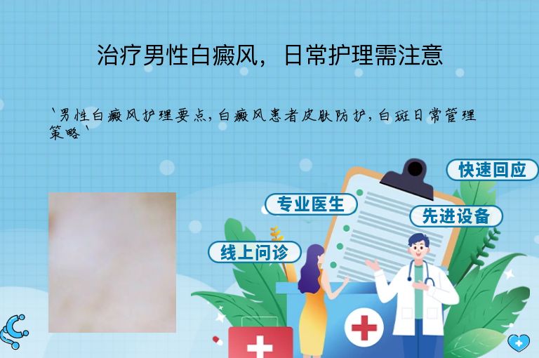 治疗男性白癜风,日常护理需注意