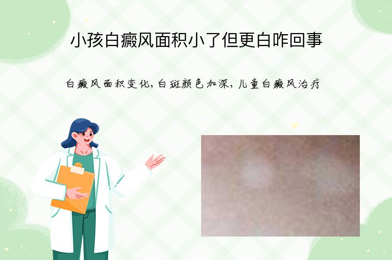 https://www.bdfsjzyy.com/d/file/p/e20777e42e32e24adbf16618a9b6b8ea.jpeg