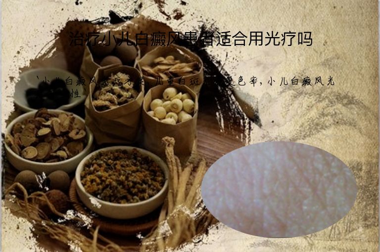 治疗小儿白癜风患者适合用光疗吗