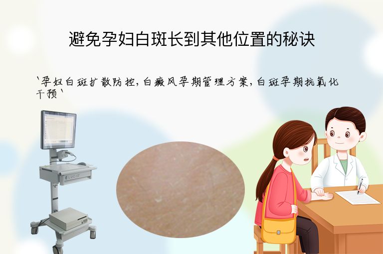 避免孕妇白斑长到其他位置的秘诀
