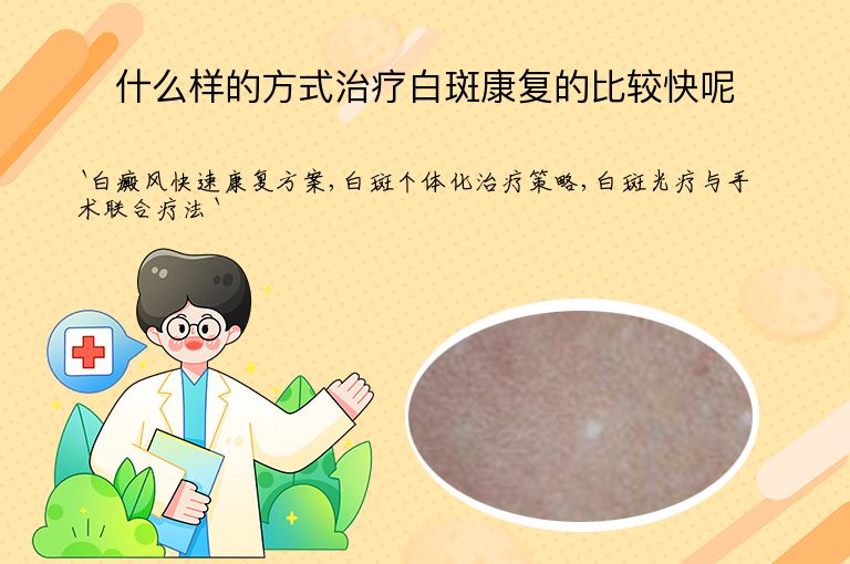 什么样的方式治疗白斑康复的比较快呢