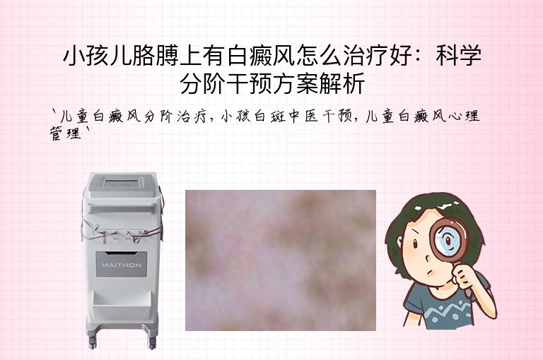 小孩儿胳膊上有白癜风怎么治疗好：科学分阶干预方案解析”