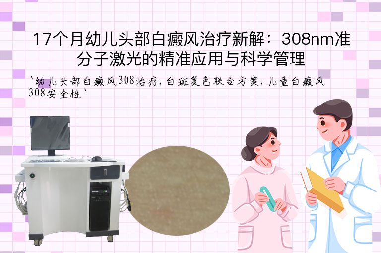 17个月幼儿头部白癜风治疗新解：308nm准分子激光的精准应用与科学管理”