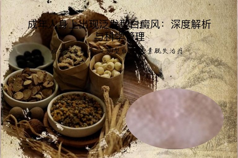 成年人身上出现泛发型白癜风:深度解析与科学管理”