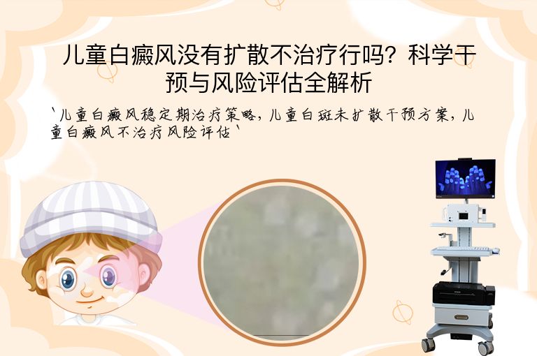 儿童白癜风没有扩散不治疗行吗?科学干预与风险评估全解析