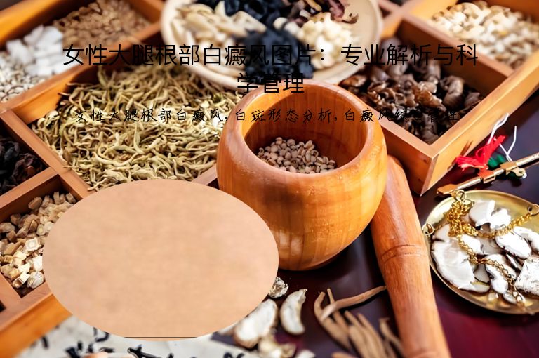 女性大腿根部白癜风图片：专业解析与科学管理”