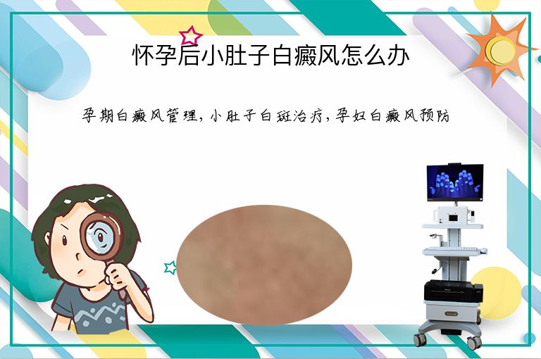 怀孕后小肚子白癜风怎么办”