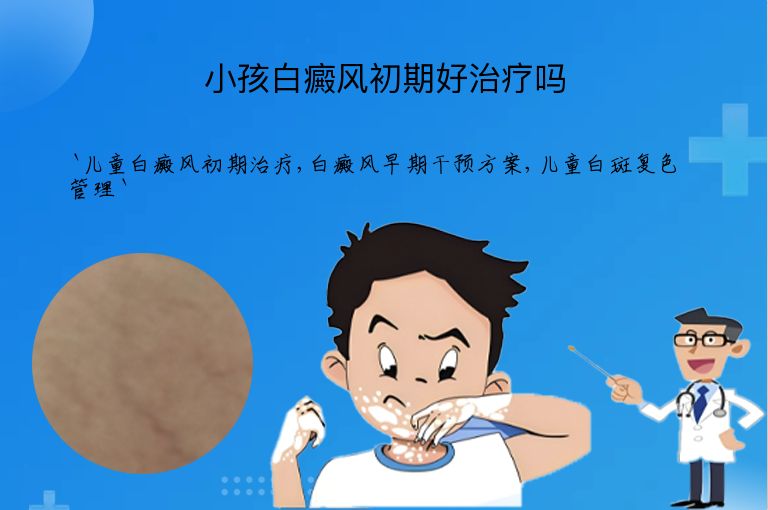 小孩白癜风初期好治疗吗