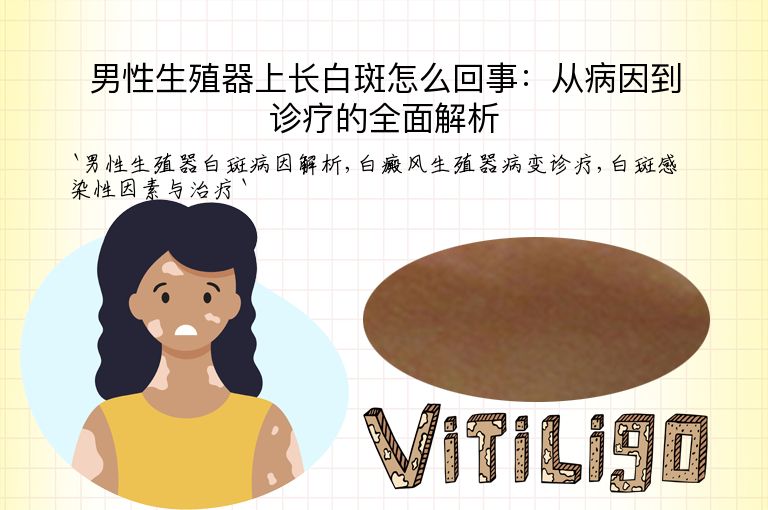 男性生殖器上长白斑怎么回事：从病因到诊疗的全面解析