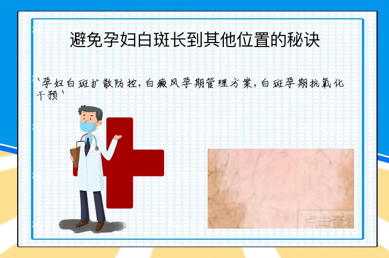 避免孕妇白斑长到其他位置的秘诀
