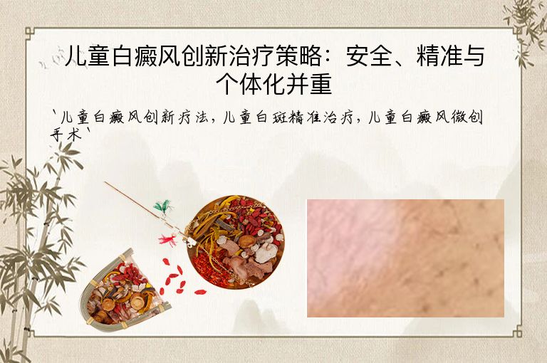 儿童白癜风创新治疗策略：安全、精准与个体化并重