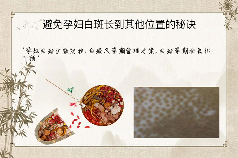 避免孕妇白斑长到其他位置的秘诀