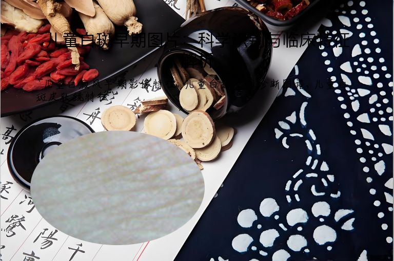 儿童白斑早期图片：科学识别与临床特征解析