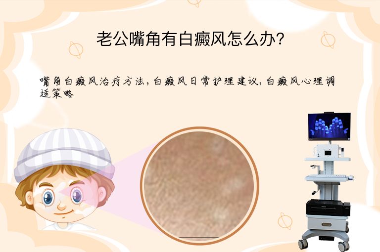 https://www.bdfsjzyy.com/d/file/p/5dbed84cbbbfb5c7df8562990e947a86.jpeg