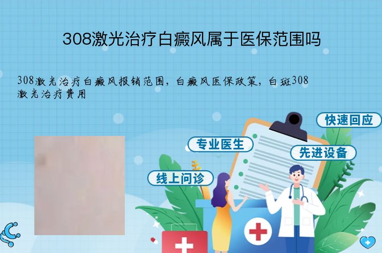 308激光治疗白癜风属于医保范围吗”