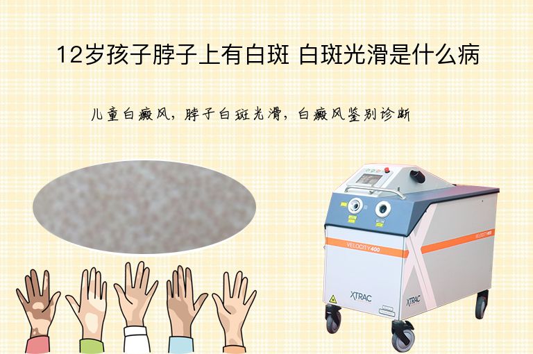 12岁孩子脖子上有白斑 白斑光滑是什么病”