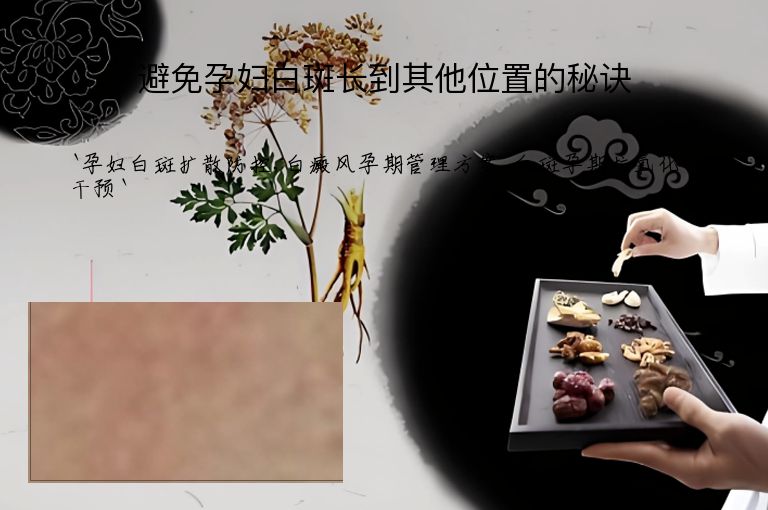 避免孕妇白斑长到其他位置的秘诀